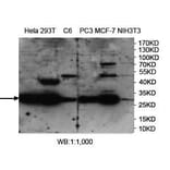 PHB2 Antibody from Signalway Antibody (39972) - Antibodies.com