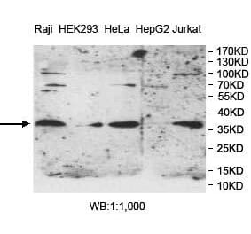 PPT1 Antibody from Signalway Antibody (39982) - Antibodies.com