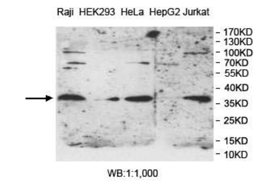 PPT1 Antibody from Signalway Antibody (39982) - Antibodies.com