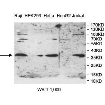PPT1 Antibody from Signalway Antibody (39982) - Antibodies.com