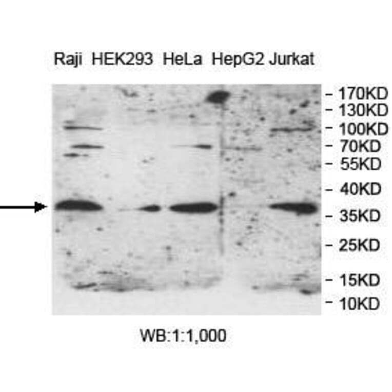 PPT1 Antibody from Signalway Antibody (39982) - Antibodies.com