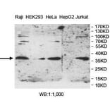 PPT1 Antibody from Signalway Antibody (39982) - Antibodies.com