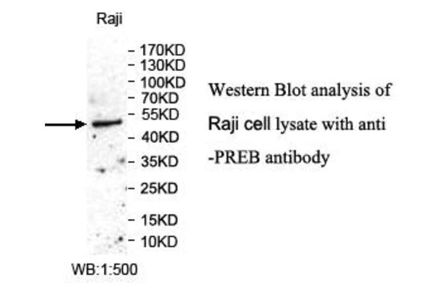 PREB Antibody from Signalway Antibody (39985) - Antibodies.com