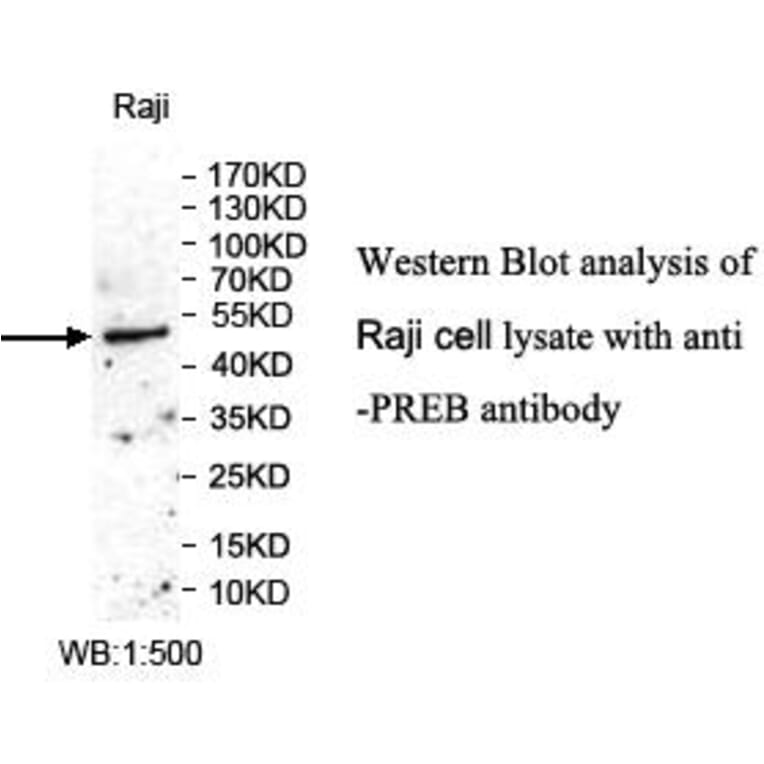 PREB Antibody from Signalway Antibody (39985) - Antibodies.com