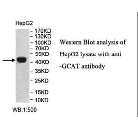 GCAT Antibody from Signalway Antibody (40005) - Antibodies.com