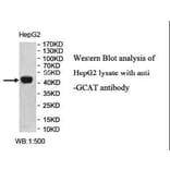 GCAT Antibody from Signalway Antibody (40005) - Antibodies.com