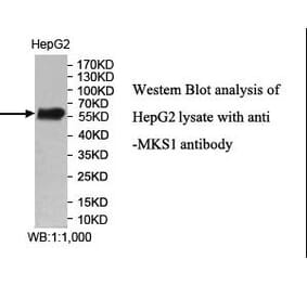 MKS1 Antibody from Signalway Antibody (40007) - Antibodies.com
