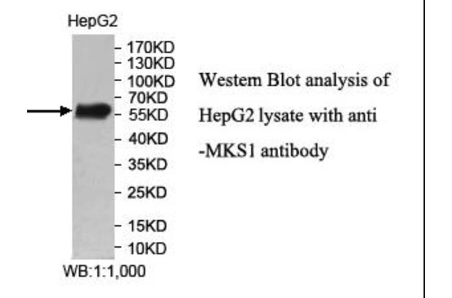 MKS1 Antibody from Signalway Antibody (40007) - Antibodies.com