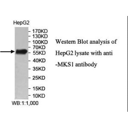 MKS1 Antibody from Signalway Antibody (40007) - Antibodies.com