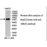 MKS1 Antibody from Signalway Antibody (40007) - Antibodies.com
