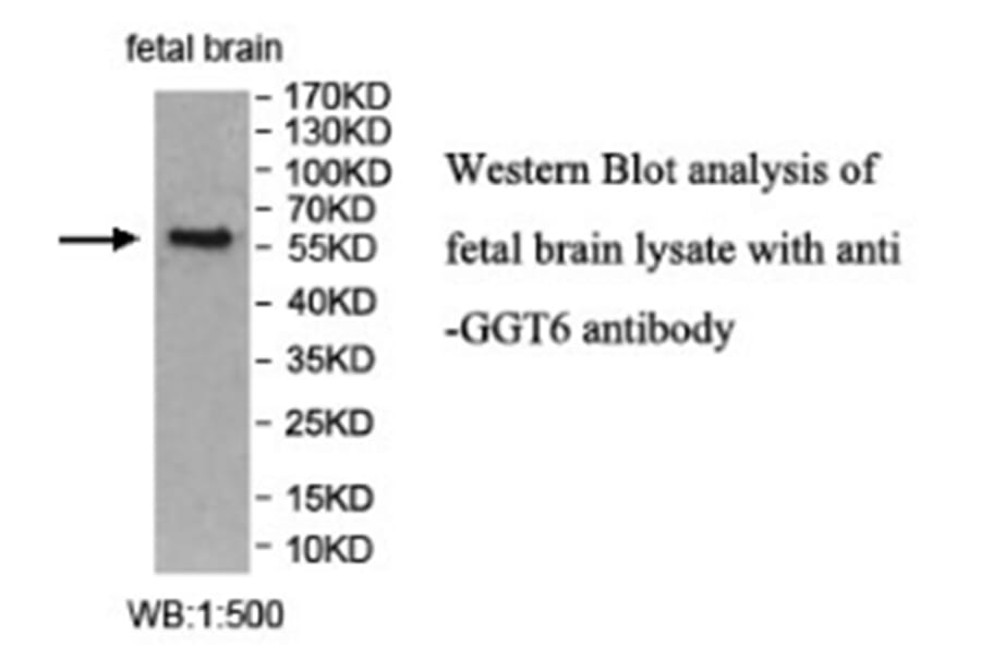 GGT6 Antibody from Signalway Antibody (40021) - Antibodies.com