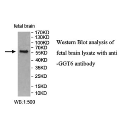 GGT6 Antibody from Signalway Antibody (40021) - Antibodies.com