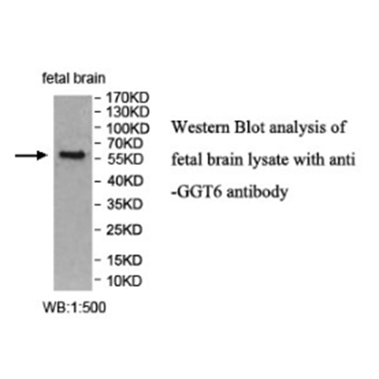 GGT6 Antibody from Signalway Antibody (40021) - Antibodies.com