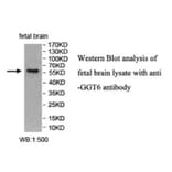 GGT6 Antibody from Signalway Antibody (40021) - Antibodies.com