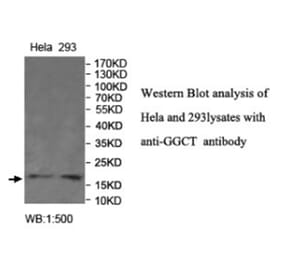 GGCT Antibody from Signalway Antibody (40022) - Antibodies.com