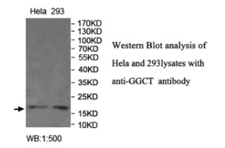 GGCT Antibody from Signalway Antibody (40022) - Antibodies.com