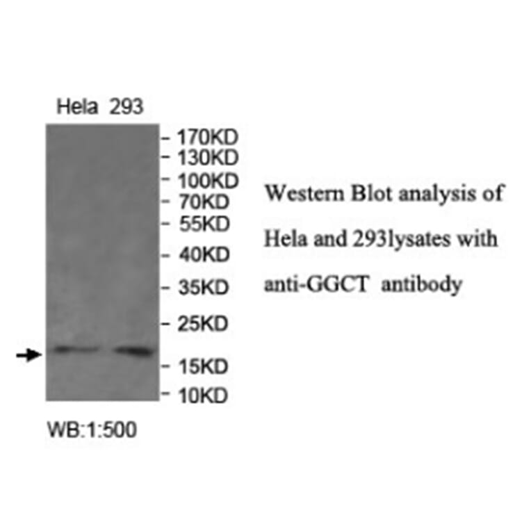 GGCT Antibody from Signalway Antibody (40022) - Antibodies.com