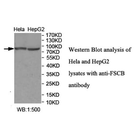 FSCB Antibody from Signalway Antibody (40035) - Antibodies.com