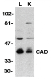 Western blot - CAD Antibody from Signalway Antibody (24038) - Antibodies.com