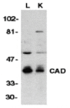 Western blot - CAD Antibody from Signalway Antibody (24038) - Antibodies.com