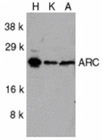 Western blot - ARC Antibody from Signalway Antibody (24052) - Antibodies.com