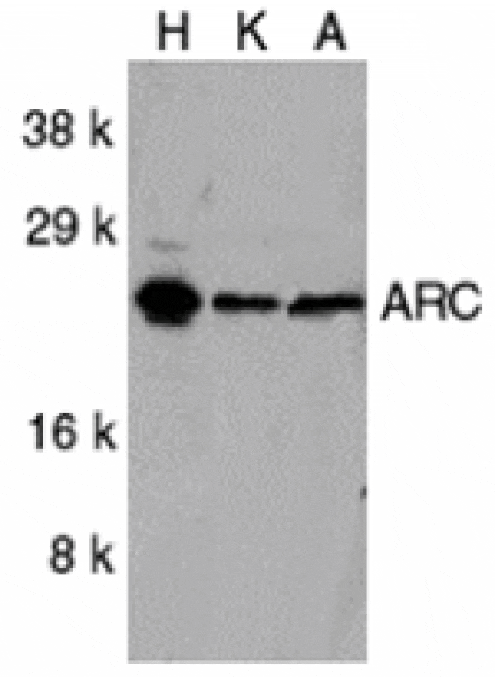 Immunohistochemistry - ARC Antibody from Signalway Antibody (24052) - Antibodies.com