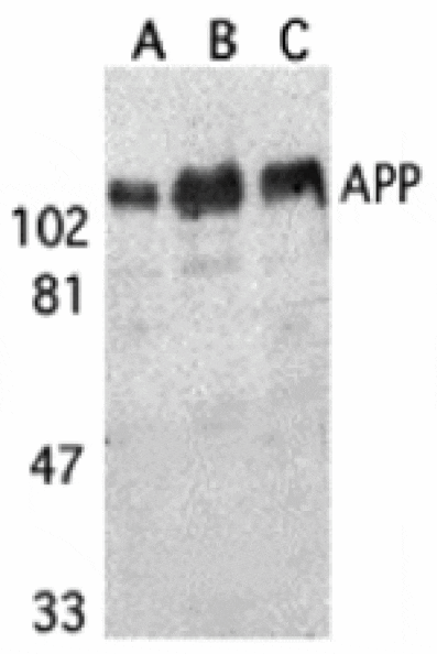 Western blot - APP Antibody from Signalway Antibody (24069) - Antibodies.com