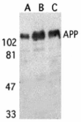 Western blot - APP Antibody from Signalway Antibody (24069) - Antibodies.com
