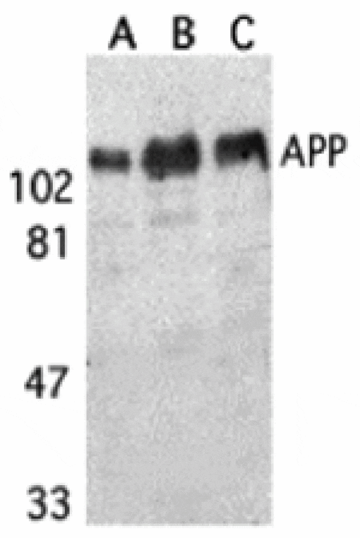 Western blot - APP Antibody from Signalway Antibody (24069) - Antibodies.com