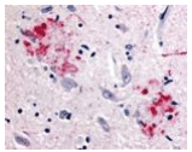 Immunohistochemistry - APP Antibody from Signalway Antibody (24069) - Antibodies.com