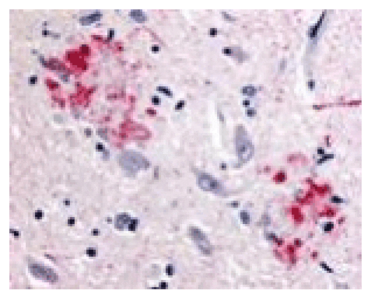 Immunohistochemistry - APP Antibody from Signalway Antibody (24069) - Antibodies.com