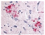 Immunohistochemistry - APP Antibody from Signalway Antibody (24069) - Antibodies.com