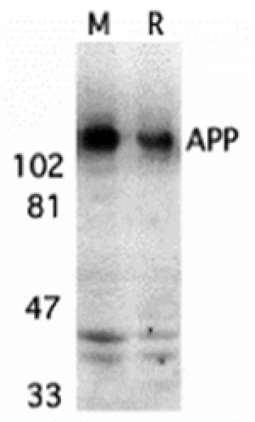 Western blot - APP Antibody from Signalway Antibody (24070) - Antibodies.com