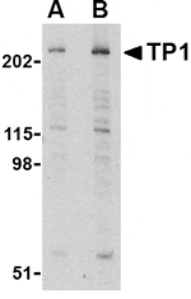 Western blot - TP1 Antibody from Signalway Antibody (24124) - Antibodies.com