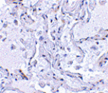 Immunohistochemistry - TP1 Antibody from Signalway Antibody (24124) - Antibodies.com