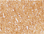 Immunohistochemistry - ATR Antibody from Signalway Antibody (24188) - Antibodies.com