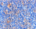 Immunohistochemistry - BAD Antibody from Signalway Antibody (24248) - Antibodies.com