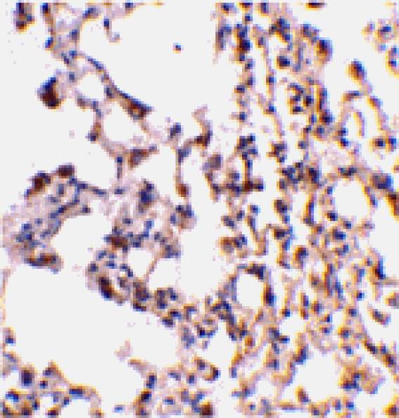 Immunohistochemistry - Bid Antibody from Signalway Antibody (24251) - Antibodies.com