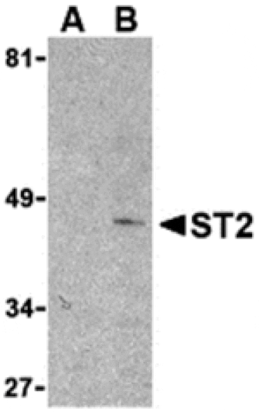 Western blot - ST2 Antibody from Signalway Antibody (24255) - Antibodies.com