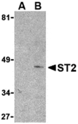 Western blot - ST2 Antibody from Signalway Antibody (24255) - Antibodies.com