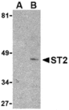 Western blot - ST2 Antibody from Signalway Antibody (24255) - Antibodies.com