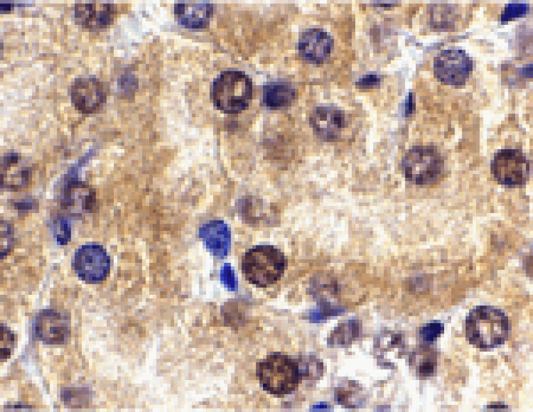 Immunohistochemistry - ST2 Antibody from Signalway Antibody (24255) - Antibodies.com