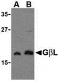 Western blot - GBL Antibody from Signalway Antibody (24305) - Antibodies.com