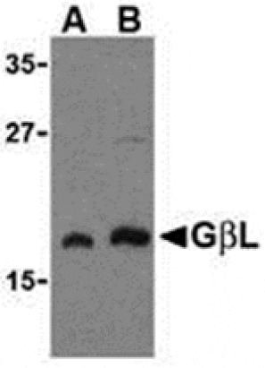 Western blot - GBL Antibody from Signalway Antibody (24305) - Antibodies.com