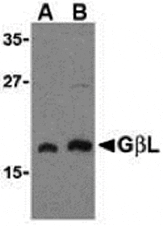 Western blot - GBL Antibody from Signalway Antibody (24305) - Antibodies.com