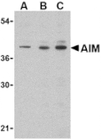 Western blot - AIM Antibody from Signalway Antibody (24414) - Antibodies.com