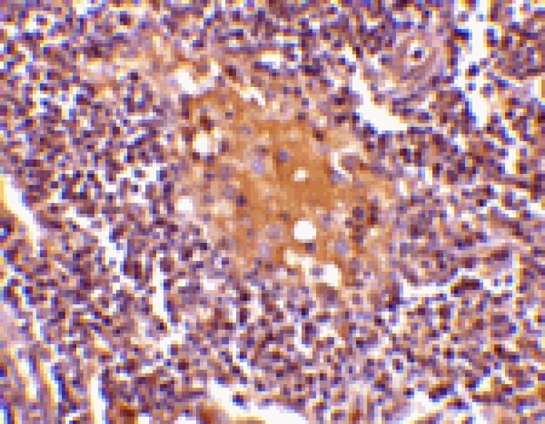 Immunohistochemistry - AIM Antibody from Signalway Antibody (24414) - Antibodies.com