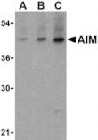 Western blot - AIM Antibody from Signalway Antibody (24415) - Antibodies.com
