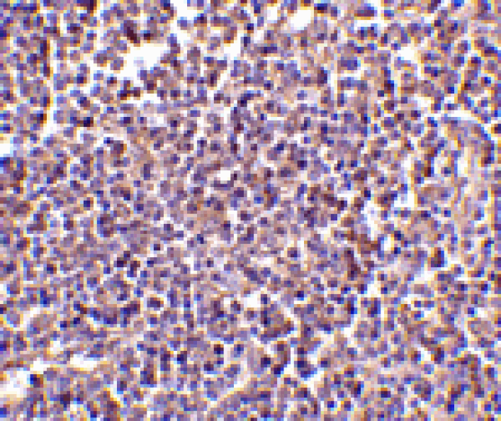 Immunohistochemistry - AIM Antibody from Signalway Antibody (24415) - Antibodies.com