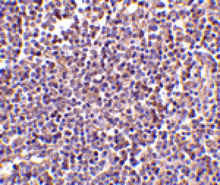 Immunohistochemistry - AIM Antibody from Signalway Antibody (24415) - Antibodies.com
